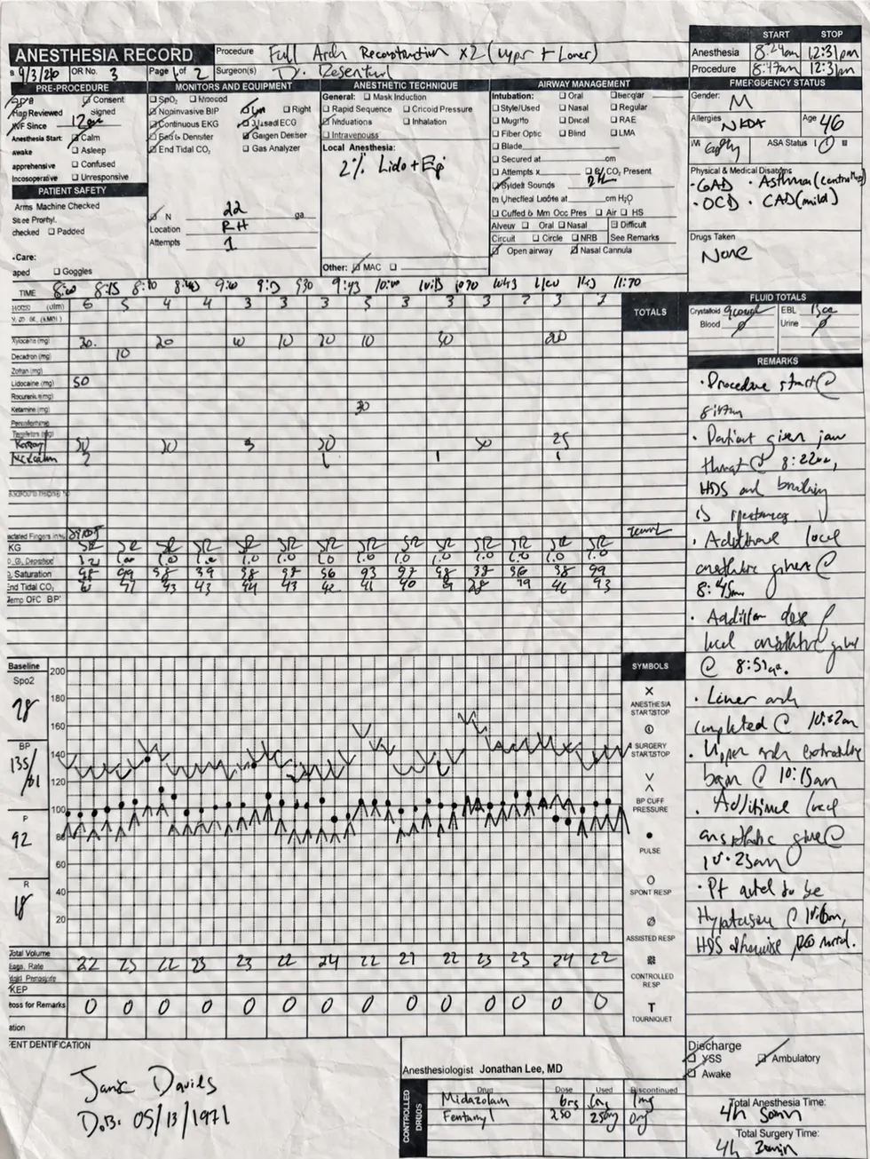 Handwritten paper anesthesia record with crossed-out notes and vitals
